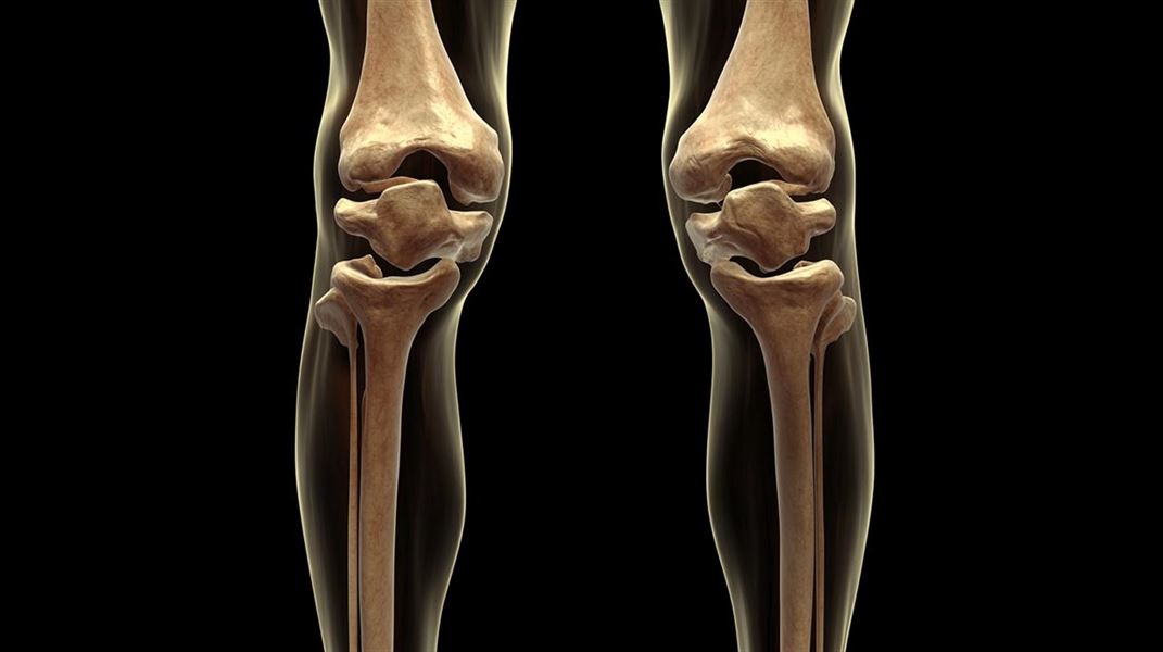 Slidgigt knæ - symptomer, behandling og genoptræning